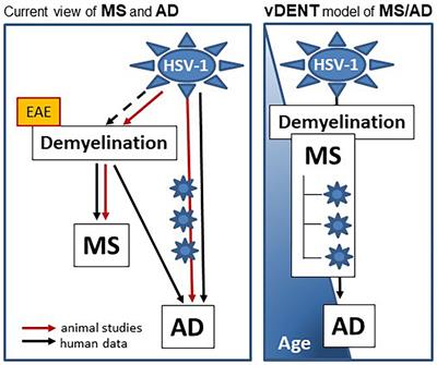 Alzheimer’s disease and multiple sclerosis: a possible connection through the viral demyelinating neurodegenerative trigger (vDENT)